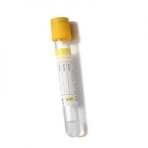 Gel and Clot Activator Tube - Macromed Philippines