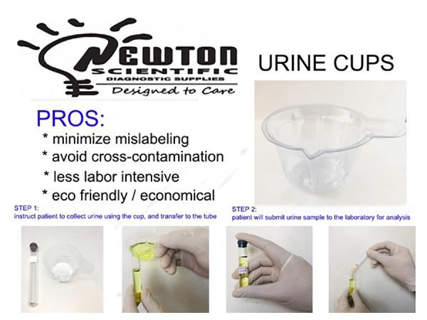 Urine Cups