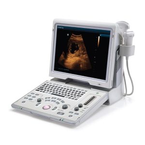 Z6 UTZ Ultrasound Machine 4d W/ 3 Probes