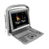 chison ultrasound machine EC06