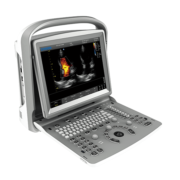 chison ultrasound machine EC06