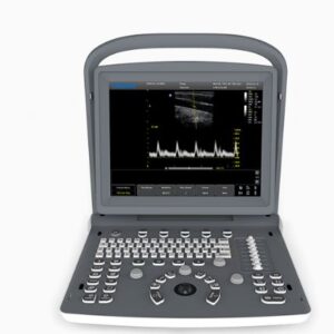 Chison Ultrasound Machine ECO2