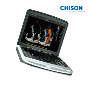 Chison SonoBook 8 Ultrasound Machine