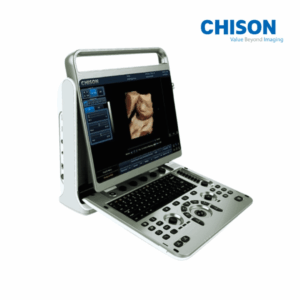 Chison Ebit 30 Ultrasound Machine